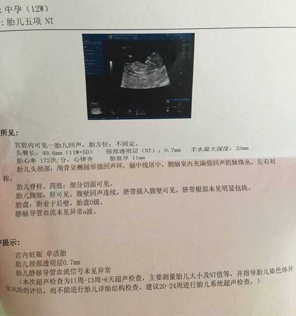 杭州三代试管医院可以选性别吗多少钱一次